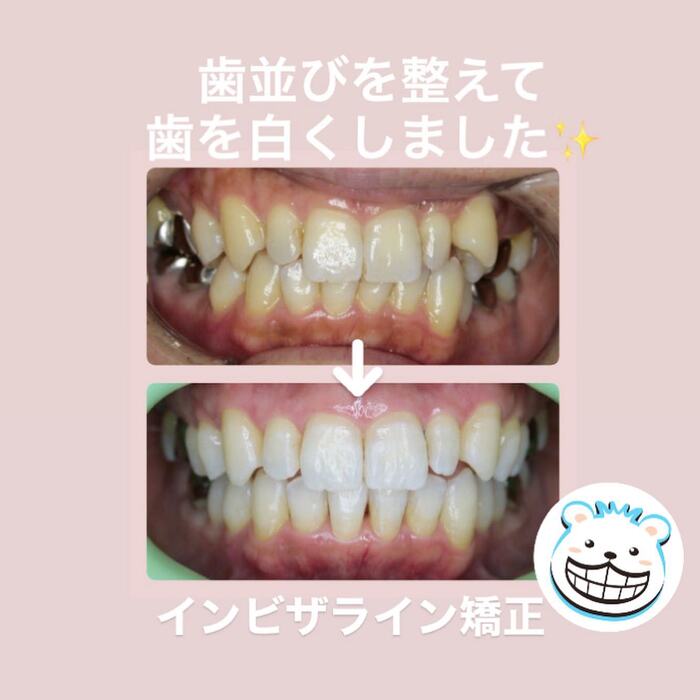 画像312