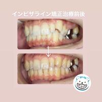 画像313