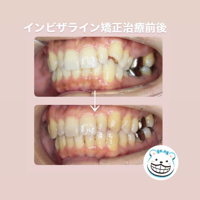 画像313