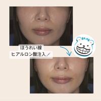 画像319