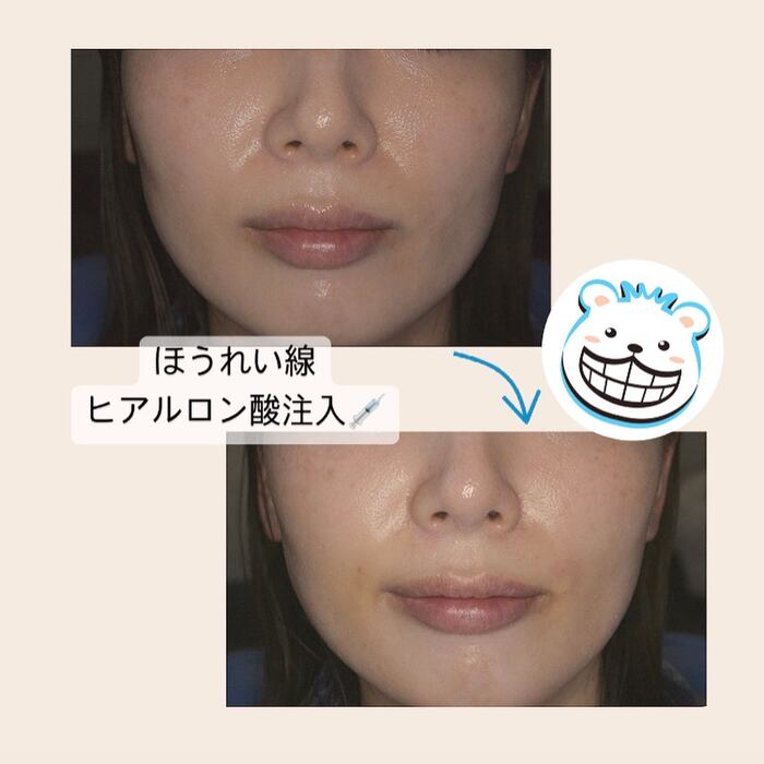 画像319