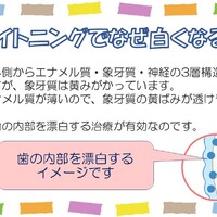 画像362