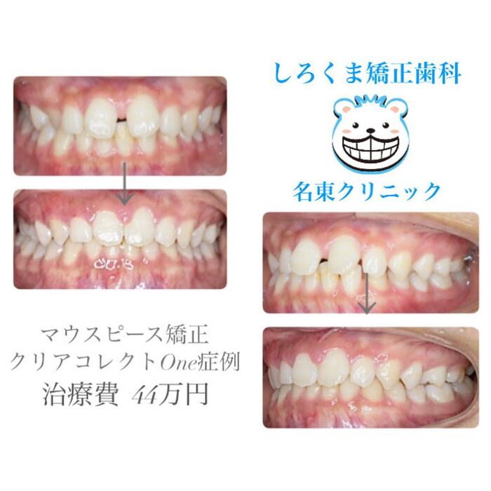 画像371