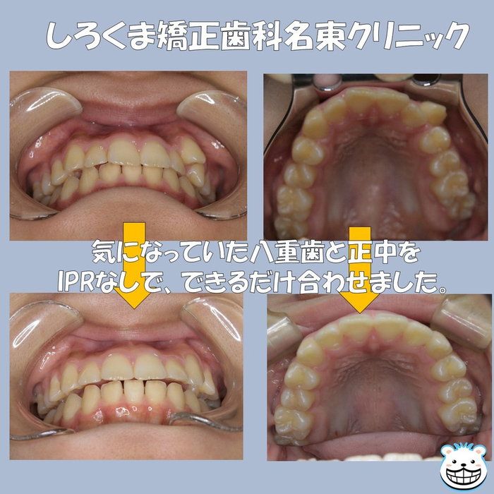 画像444