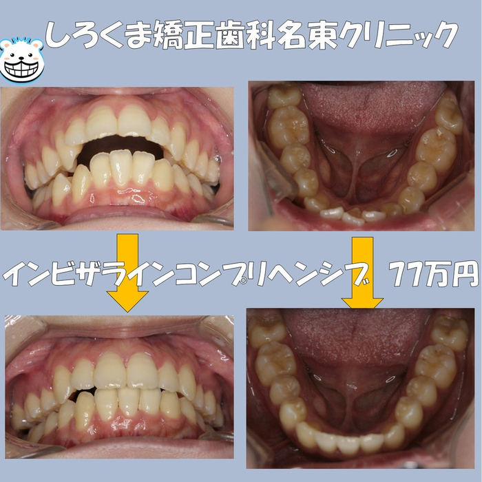 画像510