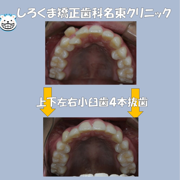 画像554