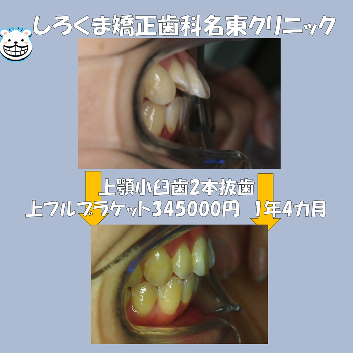 画像641