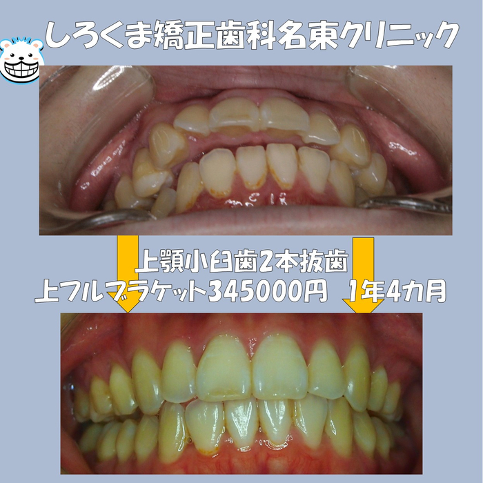 画像642